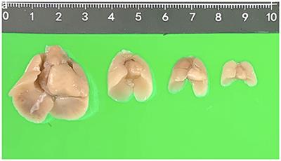 Postmortem 9.4-T MRI for Fetuses With Congenital Heart Defects Diagnosed in the First Trimester